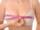 Breast Augmentation Overview