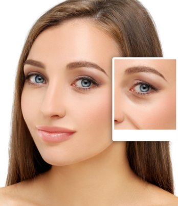 Blepharoplasty