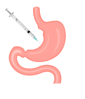 Gastric botox injection